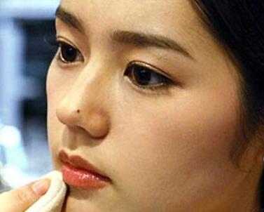 旺夫的痣是哪里长出来的,女人旺夫痣长哪里