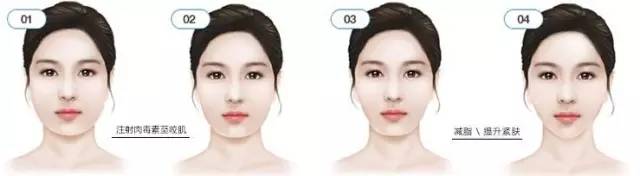 哪种脸型不能打瘦脸针,哪些脸型不适合打瘦脸针