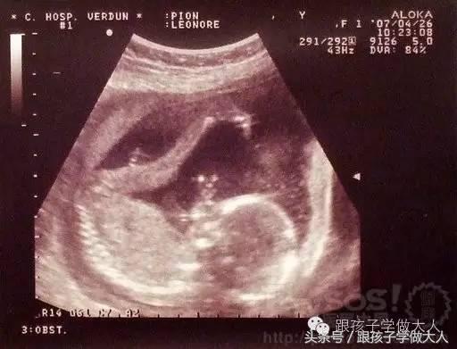 孕妈妈每周做一次b超,准妈妈孕期需要做哪些检查