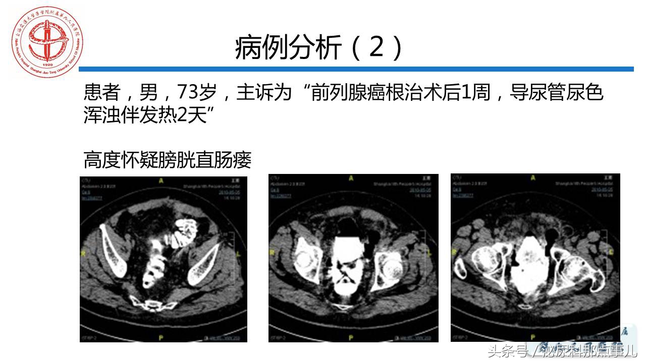 泌尿男科王忠教授,泌尿外科专家王忠教授