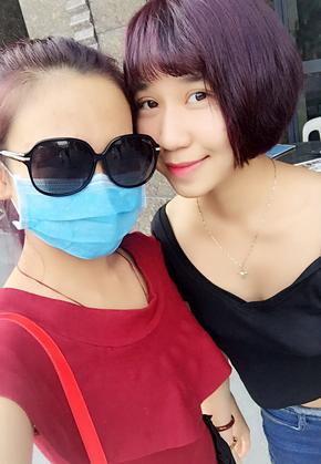 韩式三点双眼皮恢复单眼皮,韩式三点式双眼皮是永久性的吗