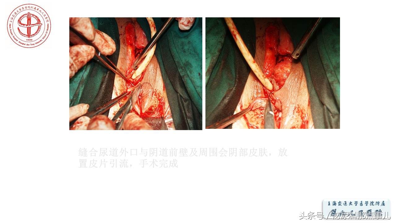 泌尿男科王忠教授,泌尿外科专家王忠教授