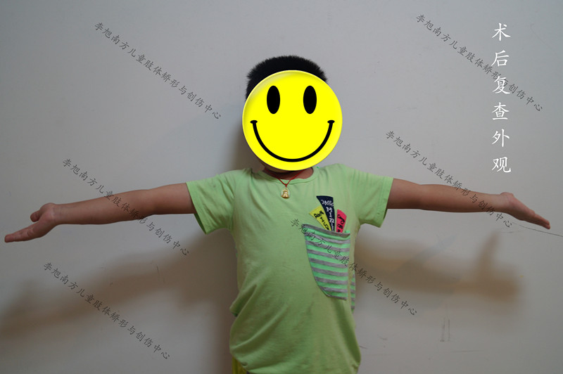 孩子胳膊摔伤后伸不直怎么办,小孩摔了跤胳膊伸不直是怎么回事