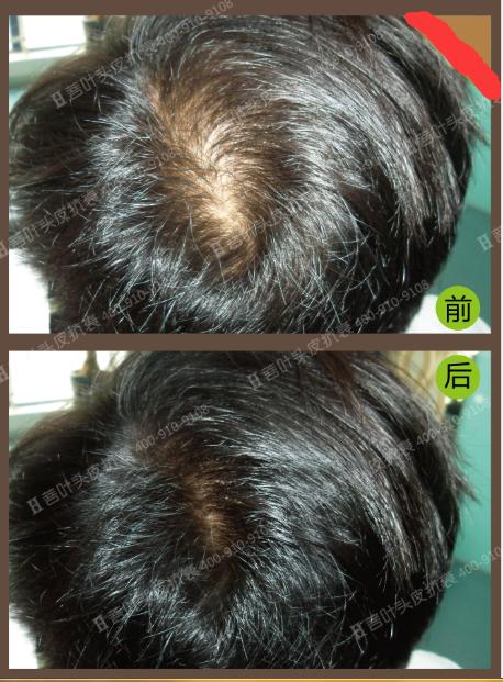 这些头发养护的误区你中过几个,这些脱发知识你一定要知道