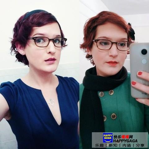 雌激素治脱发,雄性激素脱发补充雌性激素有用吗