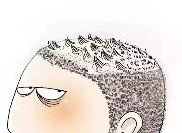 得了银屑病为什么会反复难根治呢,得了银屑病3种药膏请收藏