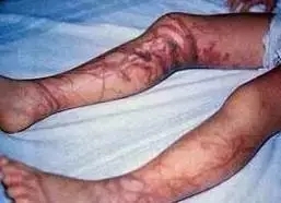 去厦门海滩玩有危险吗,在海边看到什么东西就要赶紧跑