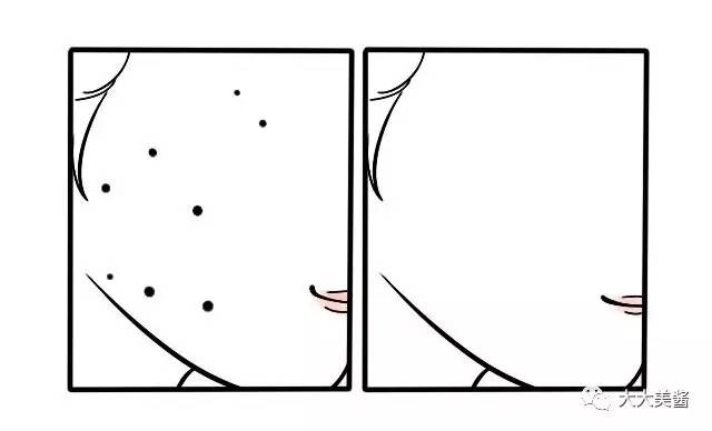 视频｜激光点痣，光洁皮肤不做小斑点汪汪