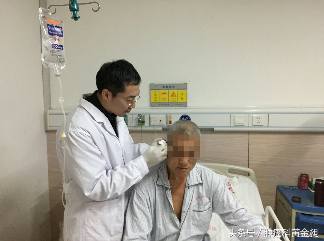 肝癌介入栓塞化疗的副作用,肿瘤介入手术栓塞血管