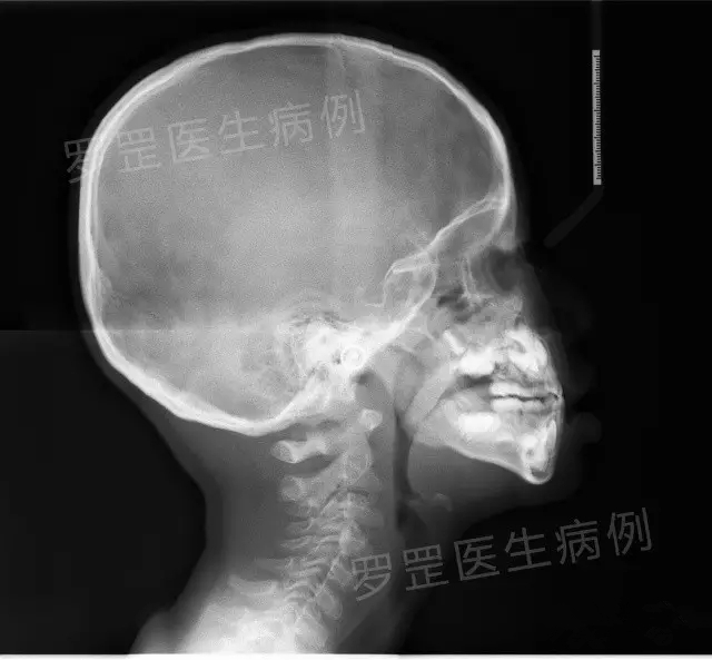 宝宝为什么喜欢张大嘴笑,小宝宝为啥抿着嘴笑