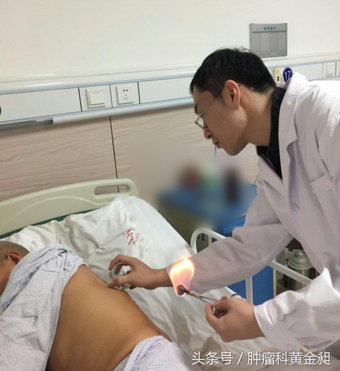 介入栓塞治疗和化疗哪个效果好,肺癌介入栓塞化疗对人的危害