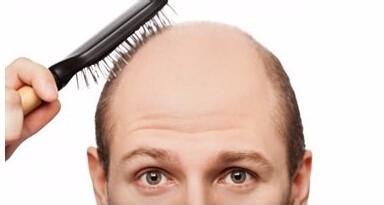 为什么最近老是掉头发呢?|年轻人脱发的七大原因