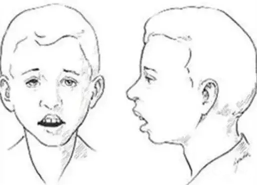 宝宝为什么喜欢张大嘴笑,小宝宝为啥抿着嘴笑