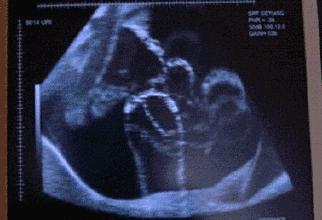 酸儿辣女到底靠谱吗,酸儿辣女真实可靠吗