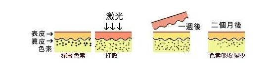 老年斑会导致雀斑吗,老年斑长大有危险吗