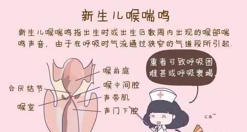 先天性喉喘鸣会影响说话吗,妈妈锦囊