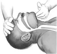 足球倒地急救,足球比赛昏厥怎么处理