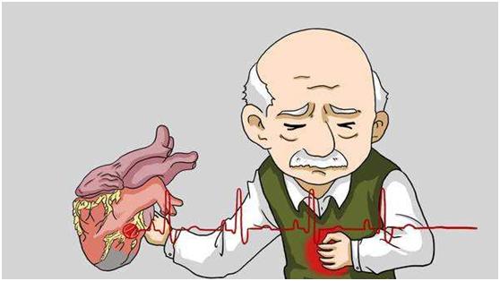 冠心病的二级预防abcde分别是什么,冠心病二级预防的最佳方案