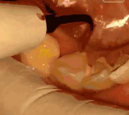 我们的牙齿是怎么来的,我们的牙齿是哪来的