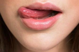 上火引起嘴唇干裂起皮用啥药,因为上火嘴唇起皮吃什么药