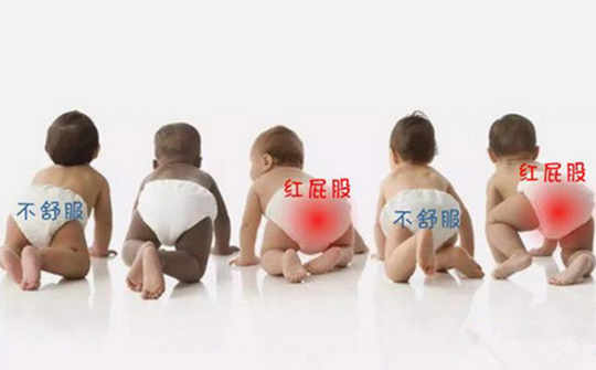 把屎把尿导致孩子脱肛是痔疮吗,婴幼儿脱肛跟把屎把尿有关系么