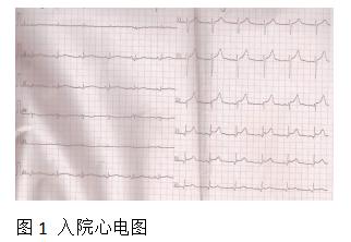 心前区疼痛、憋闷、咽部有紧缩感，伴出汗、呕吐可能是什么病？