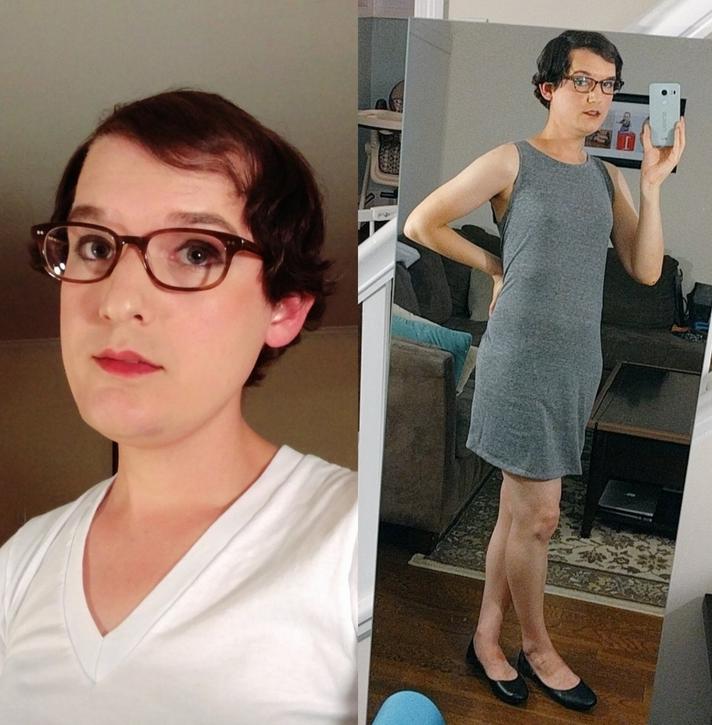 厉害了word的雌性激素，竟然还能拯救大叔的秃顶