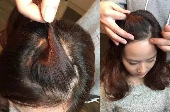 苹果梗刘海怎么扎好看,苹果刘海都有哪些款式的