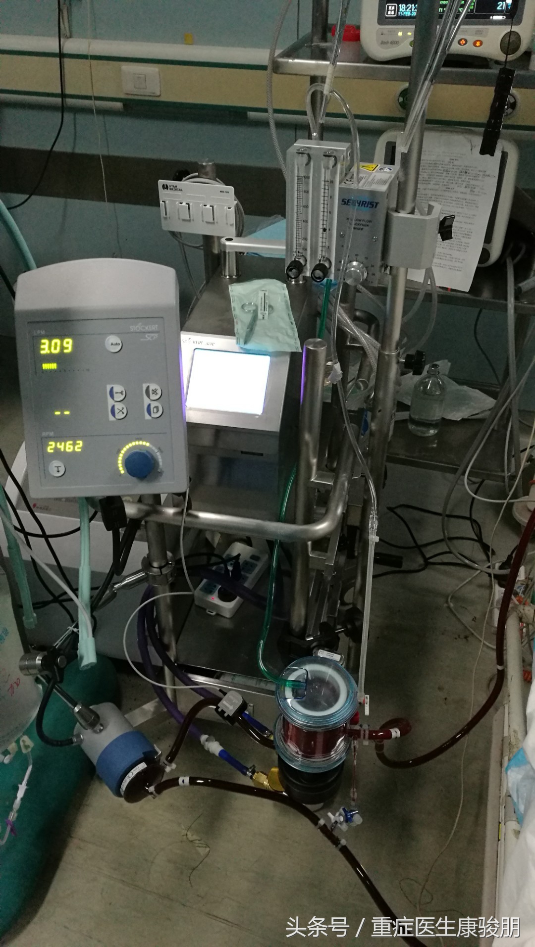 ecmo相当于哪种急救方法,ecmo到第几天开始出现并发症