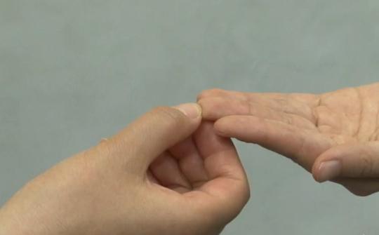 长针眼了怎么热敷,容易长针眼怎么调理