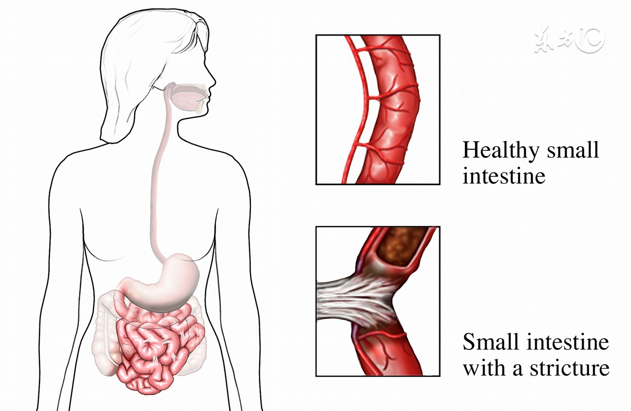 各种关节病,各种风湿骨病