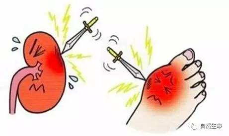 痛风叫富贵病是什么意思,痛风为什么说是富贵病
