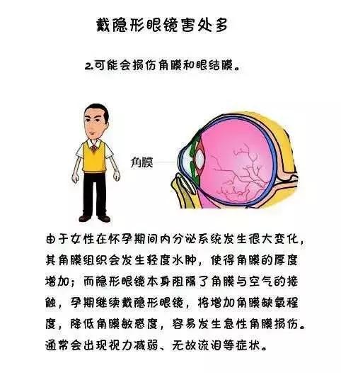 孕期如何保护自己的视力 (孕妇如何护眼)