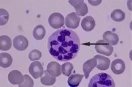 外周血细胞涂片的正常值,外周血细胞分析多长时间出结果