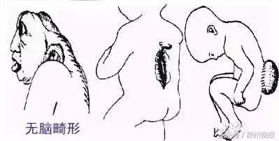 阜阳签约116个项目,阜阳签约新项目