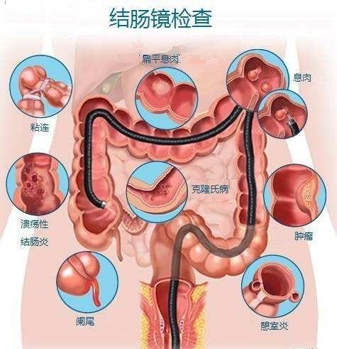 消化系统的知识口诀,关于消化系统的小知识