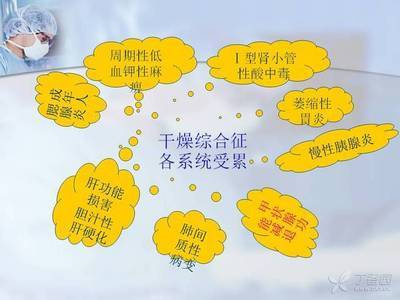 急性胃肠炎断断续续拉肚子,急性胃肠炎最后拉稀