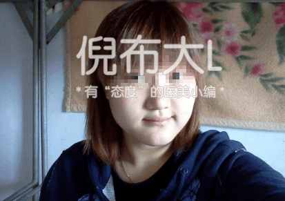 打完瘦脸针后如何维持瘦脸效果,打了瘦脸针脸上的肉会变多吗