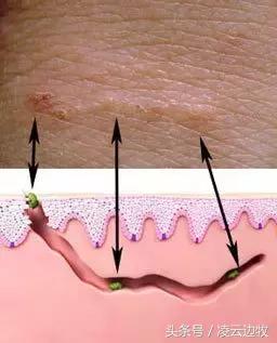 狗狗耳朵上有螨虫图,狗狗螨虫去除全过程