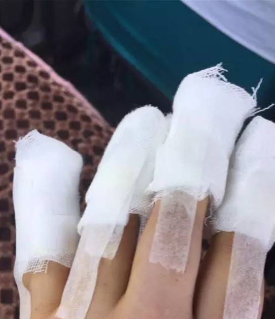 姑娘被拔手指甲,四根手指不敢做美甲