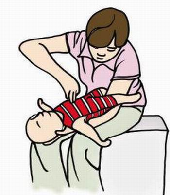 幼儿窒息急救的正确步骤,幼儿窒息救治措施