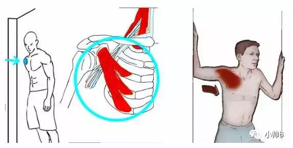 孩子圆肩驼背矫正最有效方法,胸背练多了驼背怎么改善