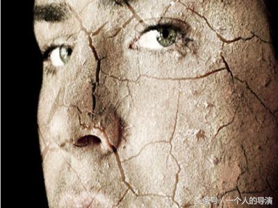 皮肤干燥综合征的症状表现,皮肤干燥发痒的表现