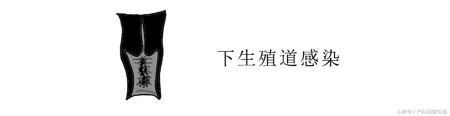 治疗盆腔炎最好最快是用什么药,盆腔炎能不能彻底治好