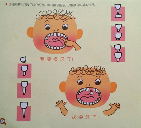 乳牙龋齿该换牙了却迟迟没动静,孩子换牙乳牙不掉新牙长歪怎么办