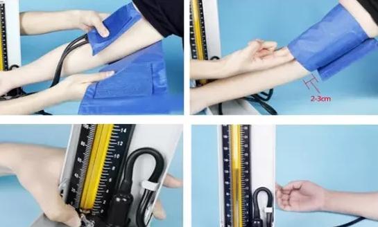 史上最全面的检查项目解读，为了你及家人的健康