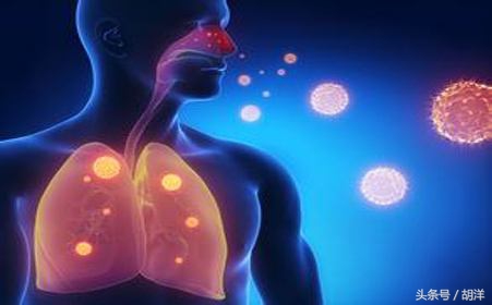 吃抗结核药物要慎重，吃不好可能副反应巨大而治不了病