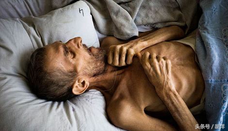 吃抗结核药物要慎重，吃不好可能副反应巨大而治不了病