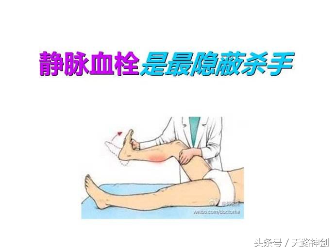 腿部肿胀、疼痛，警惕埋藏体内的“隐形杀手”