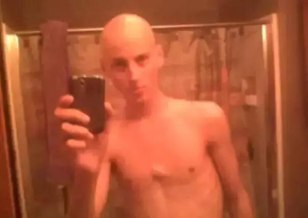 健身战胜病魔真实经历,癌症健身逆袭